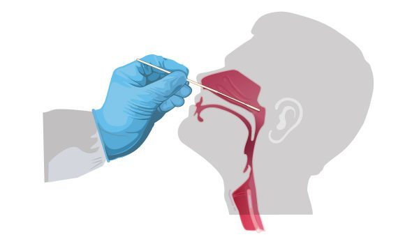 nasal-swab